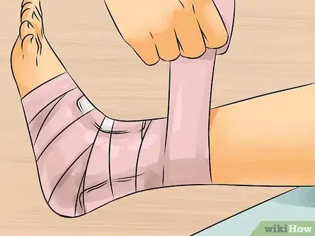 Imagen titulada Tape an Ankle Step 4