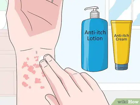 Imagen titulada Cure Lichen Planus Step 1