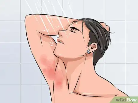 Imagen titulada Heal Chafed Skin Step 1