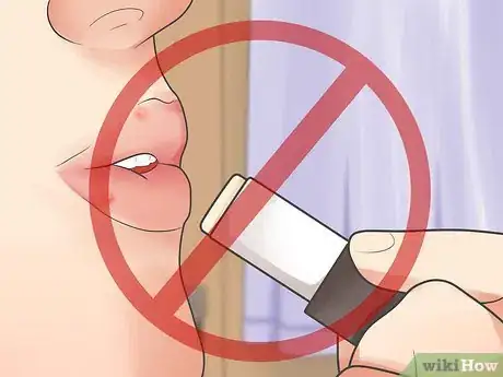 Imagen titulada Treat Acne Around the Lips Fast Step 5