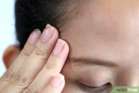 Imagen titulada Treat a Concussion Step 4
