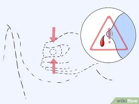 Imagen titulada Do a Breast Self Exam Step 11
