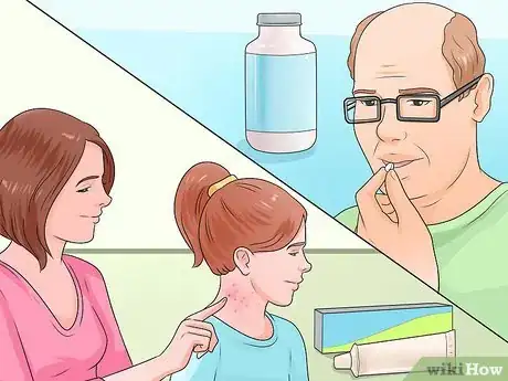 Imagen titulada Cure Scabies Step 10