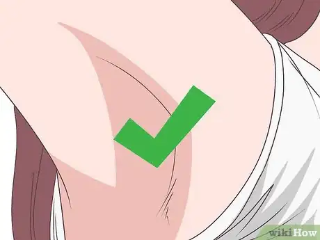 Imagen titulada Treat Intertrigo Step 1