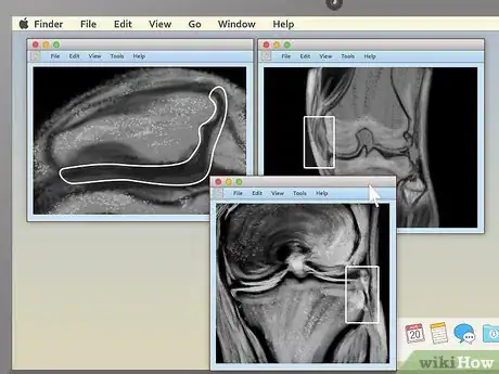 Imagen titulada Read an MRI Step 14