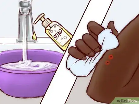 Imagen titulada Treat a Snake Bite Step 13