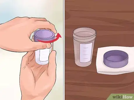 Imagen titulada Help a Male Child Provide a Urine Sample Step 9