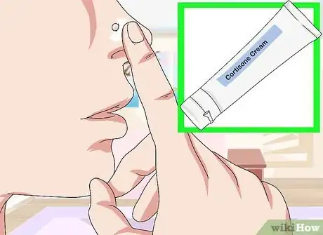 Imagen titulada Get Rid of a Nose Ring Bump Step 3