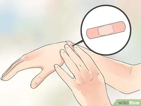 Imagen titulada Get Rid of a Cut Step 2