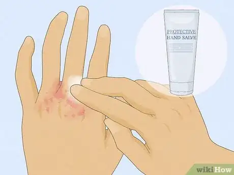 Imagen titulada Heal Raw Skin Step 2