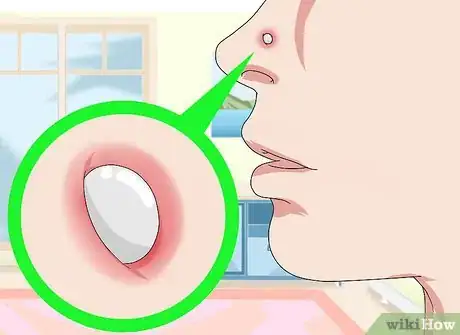 Imagen titulada Get Rid of a Nose Ring Bump Step 8