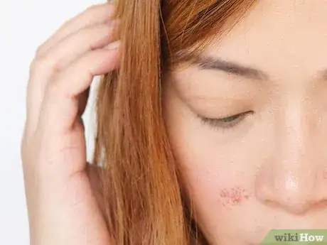 Imagen titulada Use Vitamin E Oil Step 5