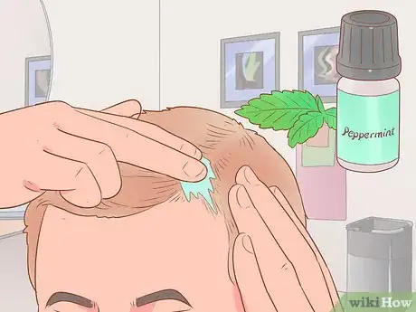 Imagen titulada Fix a Receding Hairline Step 3