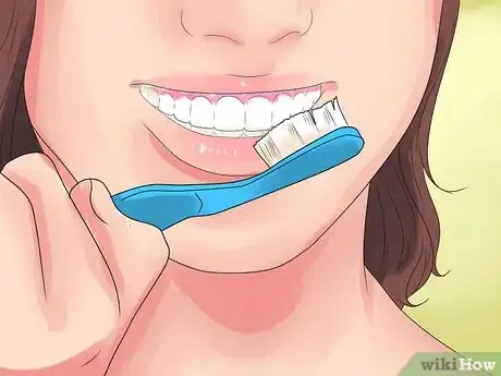 Imagen titulada Alleviate Orthodontic Brace Pain Step 14