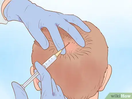 Imagen titulada Fix a Receding Hairline Step 5