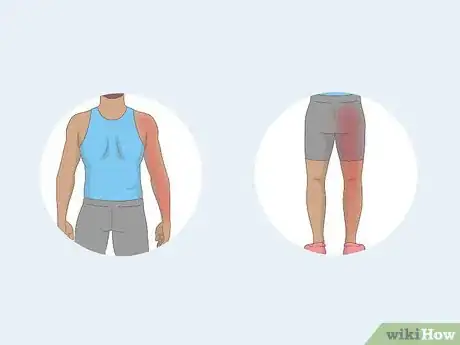 Imagen titulada Tell if Back Pain Is Due to a Muscle or Disc Step 8
