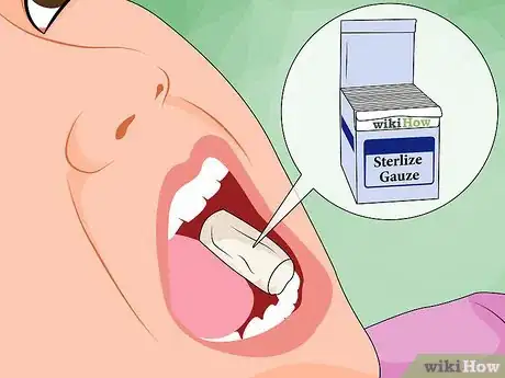 Imagen titulada Ease Wisdom Tooth Pain Step 12