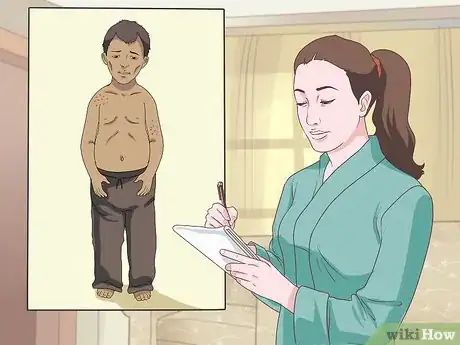 Imagen titulada Recognize an Ascaris Infection Step 5