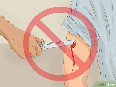 Imagen titulada Treat a Rattlesnake Bite Step 14