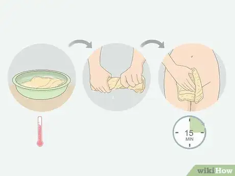 Imagen titulada Get Rid of Ingrown Pubic Hair Step 5