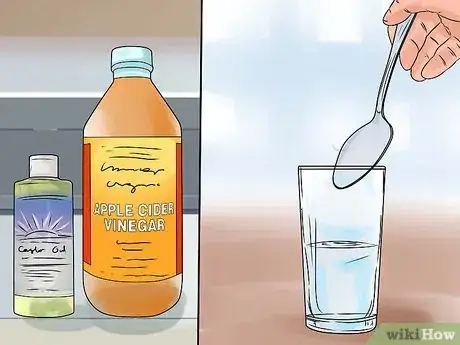 Imagen titulada Heal Blisters Step 6