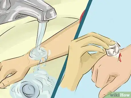 Imagen titulada Stop Bleeding Step 1