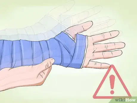 Imagen titulada Manage a Broken Arm Step 17