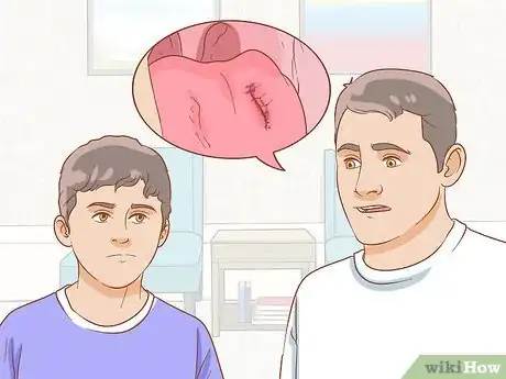 Imagen titulada Stop Tongue Bleeding Step 12