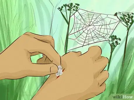 Imagen titulada Stop Bleeding Step 7