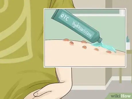 Imagen titulada Prevent Razor Burn on Your Private Parts Step 9