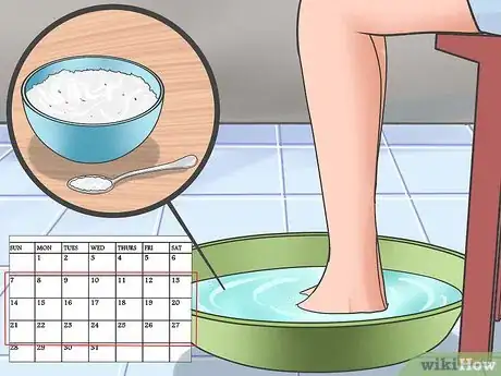 Imagen titulada Tell if You Have an Ingrown Toenail Step 11