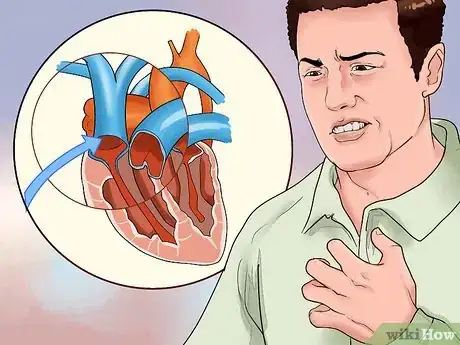 Imagen titulada Diagnose a Thymoma Step 6