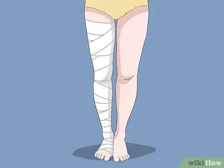 Imagen titulada Improve Lymphatic Drainage in the Legs Step 6