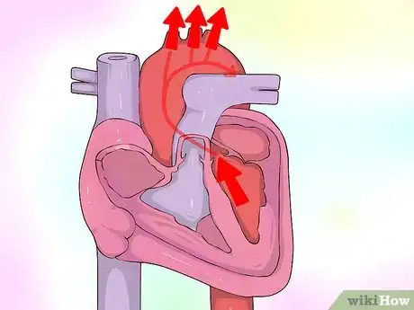 Imagen titulada Interpret Echocardiograms Step 2