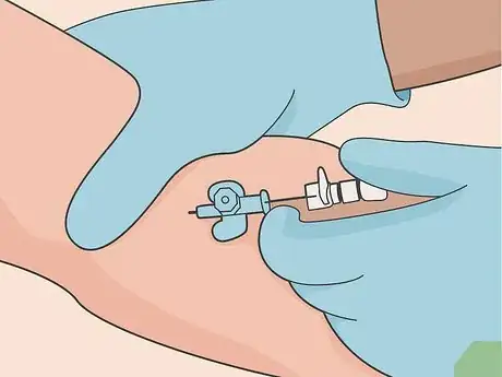 Imagen titulada Get a Brain Scan Step 17