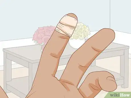 Imagen titulada Treat a Blood Blister Step 6