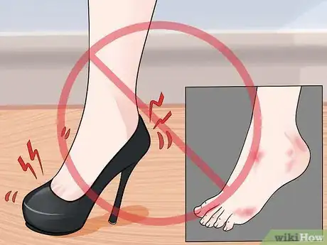 Imagen titulada Prevent Foot Blisters Step 2