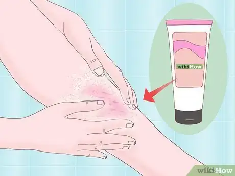 Imagen titulada Deal with Thick Leg Hair Step 5