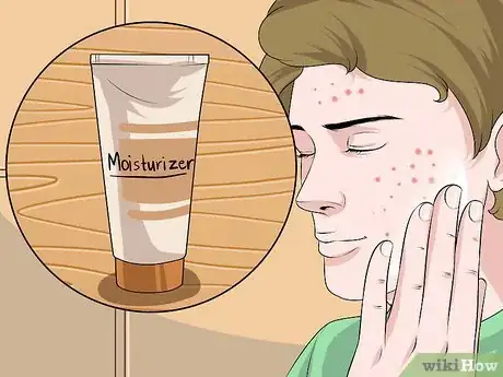Imagen titulada Dry Out a Pimple Step 11