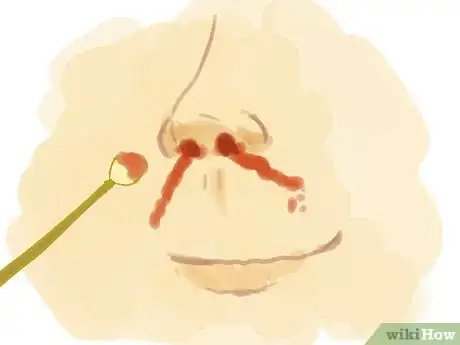 Imagen titulada Fake a Nose Bleed Step 2