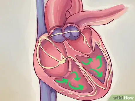 Imagen titulada Interpret Echocardiograms Step 3