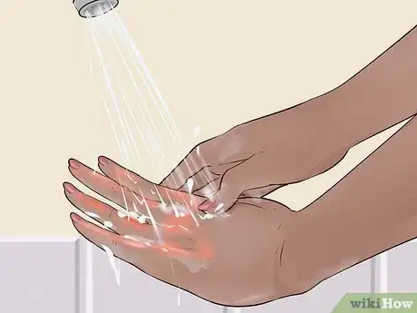 Imagen titulada Do Basic First Aid Step 16