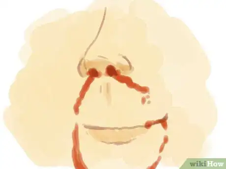 Imagen titulada Fake a Nose Bleed Step 3