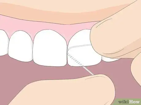 Imagen titulada Floss Step 6