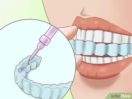 Imagen titulada Have the Perfect Smile Step 11