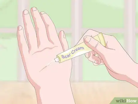Imagen titulada Get Rid of Scars Step 5