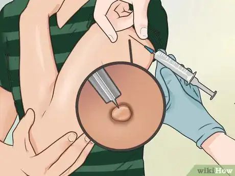 Imagen titulada Take Cephalexin Step 16