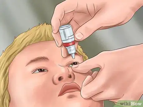 Imagen titulada Administer Eye Drops in Children Step 24