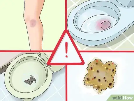 Imagen titulada Make Blood Coagulate Faster Step 5