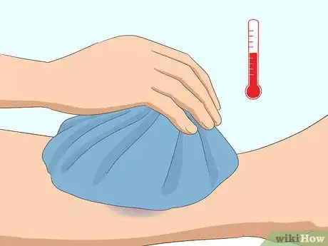 Imagen titulada Make a Bruise Go Away Faster Step 2